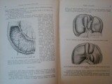CHIRURGIA CAILOR BILIARE EXTRAHEPATICE de I. TURAI, D. GEROTA 1957