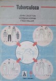Tuberculoza John Crofton, Horne, Miller - Macmillan 1992, Carte Medicala, Romana, Hardcover