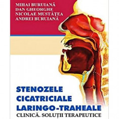 Stenozele cicatriciale laringo-traheale - Paperback - Andrei Buruiană, Dan Gheorghe, Mihai Buruiană, Nicolae Mustăţea - All