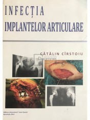 Catalin Cirstoiu - Infectia implantelor articulare (Editia: 2013) foto