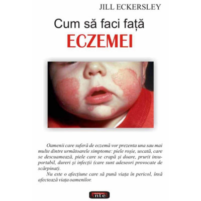 Cum sa faci fata eczemei - Jill Eckersley foto