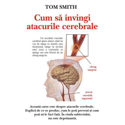 Cum sa invingi atacurile cerebrale-Tom Smith foto