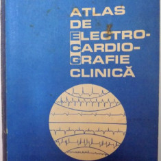 ATLAS DE ELECTROCARDIOGRAFIE CLINICA , VOLUMUL II de ELECROCARDIOGRAME de CORNELIU DUDEA , 1988 , PROBLEME LA COPERTA SPATE