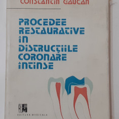 Gaucan - Procedee Restaurative In Distructiile Coronare Intinse STOMATOLOGIE