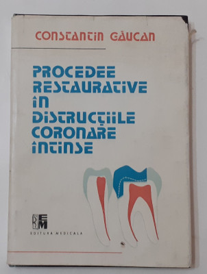 Gaucan - Procedee Restaurative In Distructiile Coronare Intinse STOMATOLOGIE foto