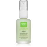 MartiDerm Acniover Serum ser impotriva acneei 30 ml