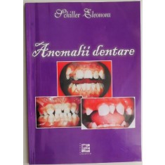 Anomalii dentare &ndash; Schiller Eleonora
