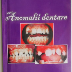 Anomalii dentare – Schiller Eleonora