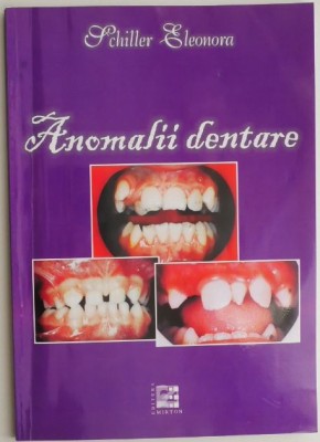 Anomalii dentare &amp;ndash; Schiller Eleonora foto