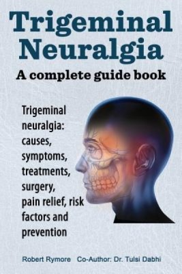 Trigeminal Neuralgia: A Complete Guide Book. Trigeminal Neuralgia: Causes, Symptoms, Treatments, Surgery, foto
