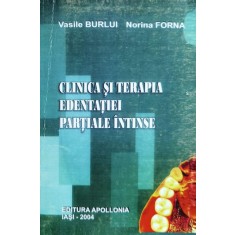 Clinica Si Terapia Edentatiei Partiale Intinse - Vasile Burlui, Norina Forna , O300