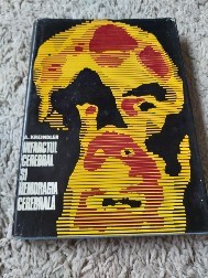 Infarctul cerebral si hemoragia cerebrala foto