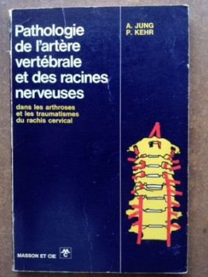 Pathologie de l`artere vertebrale et des racines nerveuses- A. Jung, P. Kehr foto