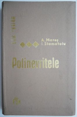 Cum tratam polinevritele &amp;ndash; A. Mares foto