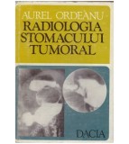 Aurel Ordeanu - Radiologia stomacului tumoral - 126669