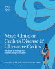 Mayo Clinic on Crohn&#039;s Disease and Ulcerative Colitis: Strategies to Manage Your Ibd and Thrive