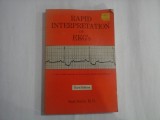 RAPID INTERPRETATION OF EKG'S - DALE DUBIN, M. D.
