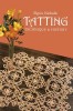 Tatting: Technique and History