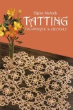 Tatting: Technique and History