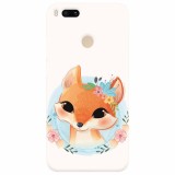 Husa silicon pentru Xiaomi Mi A1, Foxy