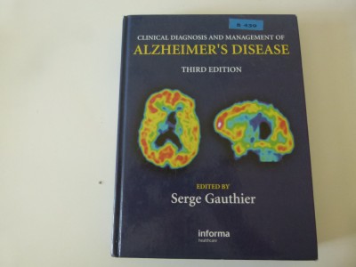 Alzheimers disease foto