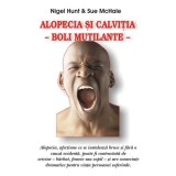 Alopecia si calvitia - boli mutilante - Nigel Hunt Sue McHale