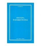 Robinson - Celulita, in sfarsit invinsa - 111715