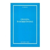 Robinson - Celulita, in sfarsit invinsa - 111715