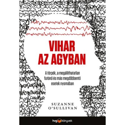 Vihar az agyban foto