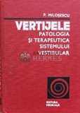 Cumpara ieftin Vertijele. Patologia si terapeutica sistemului vestibular - 1978 - Pantelimon Milosescu (T135)