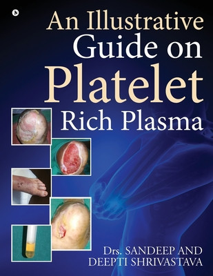 An Illustrative Guide on Platelet Rich Plasma foto