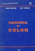 Cancerul de colon