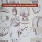 CORTICOTHERAPIE LOCALE EN RHUMATOLOGIE-A. DENIS -236051
