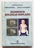 Ecografia Soldului Displazic, Stefan Cristea, Mihai Popescu, Dinu Antonescu, medicina, radiologie, radiografie, imagistica medicala, diagnostic