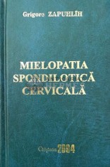 MIELOPATIA SPONDILOTICA CERVICALA - 2004 - Grigore Zapuhlih ($Q113) foto