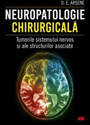 Neuropatologie chirurgicala. Tumorile sistemului nervos si ale structurilor asociate - Dr. Dorel Eugen Arsene foto