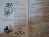 CHIRURGIA RECTULUI de F. MANDACHE, I. CHIRICUTA , 1957 * EDITIE CARTONATA