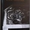Xilogravura &ndash; matrice stilistica. Re-scrieri. Cronicile vremii &ndash; Suzana Fantanaru