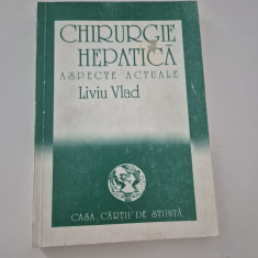 Medicina Liviu Vlad Chirurgie hepatica