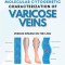 A Study on Dermatoglyphics and Molecular Cytogenetic Characterization of Varicose Veins