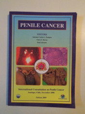 PENILE CANCER de ANTONIO CARLOS L. POMPEO , CHRIS F. HEYNS , PAUL ABRAMS , 2009 , CONTIE CD foto