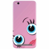 Husa silicon pentru Xiaomi Redmi 5A, Girly Cute