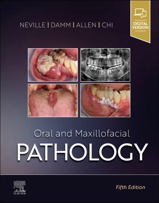 Oral and Maxillofacial Pathology foto