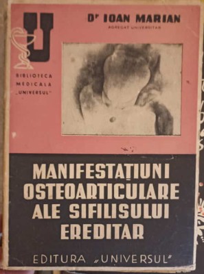 MANIFESTATIUNI OSTEOARTICULARE ALE SIFILISULUI EREDITAR-IOAN MARIAN-253583 foto