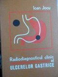 Radiodiagnosticul Clinic Al Ulcerelor Gastrice - Ioan Jocu ,523714