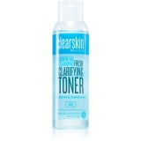Avon Clearskin Blackhead Clearing apa pentru curatarea tenului impotriva punctelor negre 100 ml