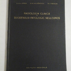 RADIOLOGIA CLINICA A DUODENULUI PATOLOGIC NEULCEROS - I. BIRZU * M. VULCANESCU * V. NECULA