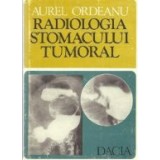 Radiologia stomacului tumoral