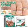 South Moon* 2 Buc.Crema pentru ciuperca unghiilor, elimina ciuperca, reparator