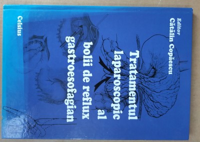 TRATAMENTUL LAPAROSCOPIC AL BOLII DE REFLUX GASTROESOFAGIAN( CONTINE CD)- CATALIN COPAESCI-X4. foto